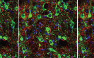 L’acétylcholine et les circuits neuronaux de la dépression