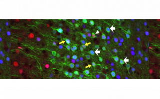 Effet paradoxal des antidéprésseurs pendant le développement : une cible inattendue dans le cortex préfrontal