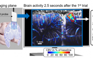 Activité cérébrale lors de tâches complexes révélée par la neuroimagerie ultrasonore ultrarapide