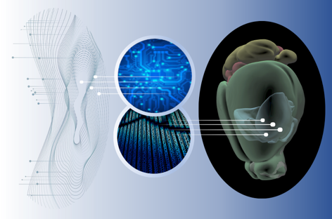 Maladie de Huntington : l’alliance de la génomique et de l’intelligence artificielle met en avant un rôle central des pertes de résilience neuronale et une feuille de route pour les empêcher