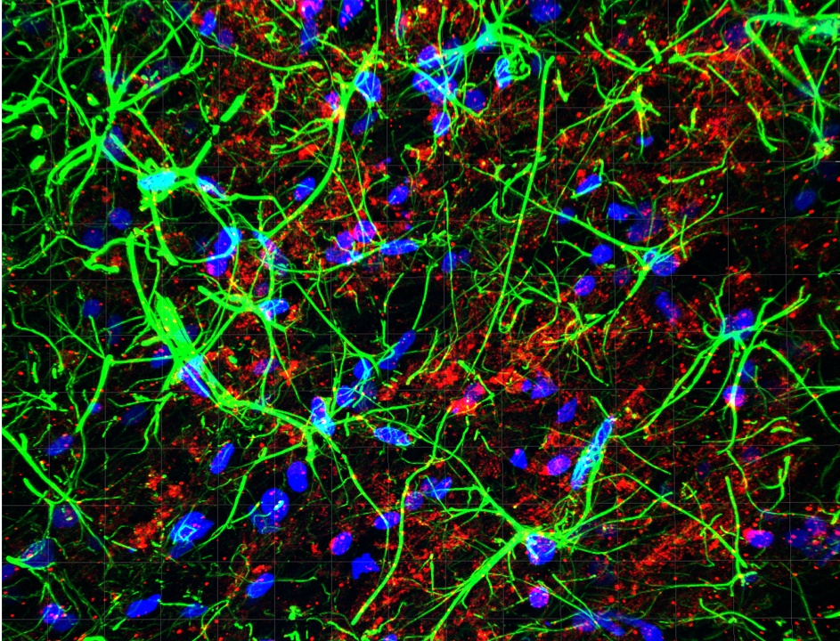 Les astrocytes, ces petites étoiles qui guident nos émotions