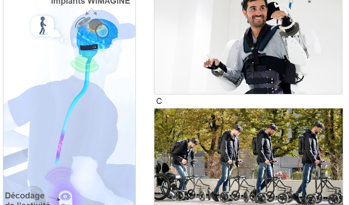 Interface cerveau-machine pour la restauration du mouvement : l’Intelligence Artificielle au cœur du décodage de l’activité corticale